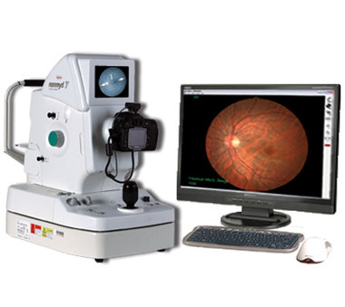 Digital Retinal Camera Kowa nonmyd 7 with 16 Megapixels, NEW!, Item No.: 0111340