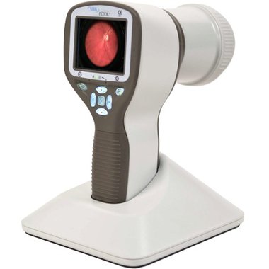 Volk Pictor Anterior Kit, handheld Digital Retinal Camera, NEW!, Item No.: 15032012-5